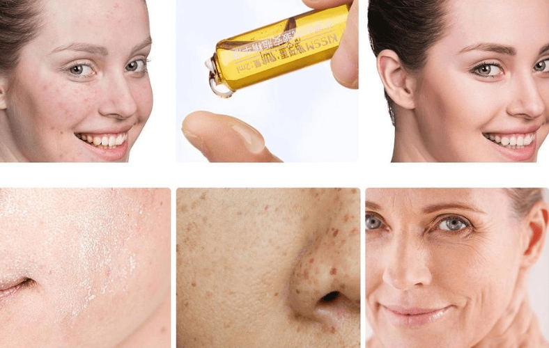 Portable Hyaluronic Acid Ampoule Face Serum Shrink Pores Anti-Ance Nicotinamide Whitening Essence