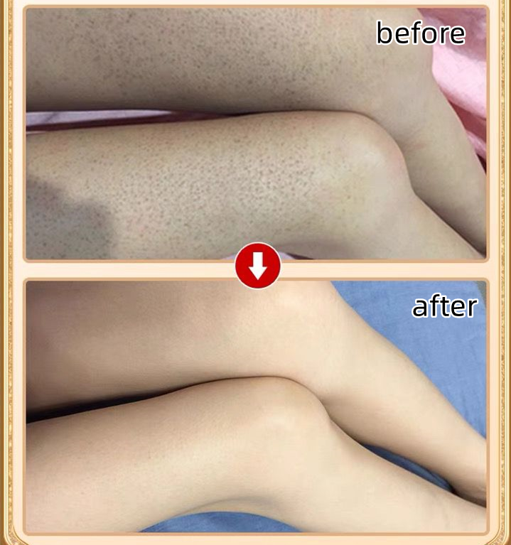 Exfoliating Gel for Facial Whole Body Cleansing Moisturizing