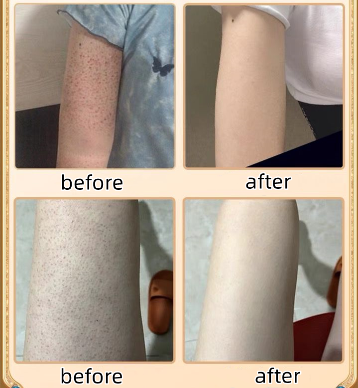 Exfoliating Gel for Facial Whole Body Cleansing Moisturizing