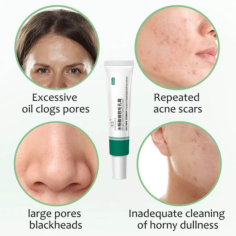 Salicylic Acid Cream Oil Control Anti-Acne Face Cream