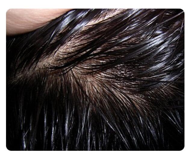 Quick Deoiling Hair Shampoo Powder Oil Control Fluffy Powder Lazy Bangs Wash-free Shampoo Powder Pregnant Women Dry Hair Powder