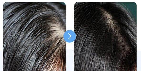 Quick Deoiling Hair Shampoo Powder Oil Control Fluffy Powder Lazy Bangs Wash-free Shampoo Powder Pregnant Women Dry Hair Powder