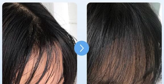 Quick Deoiling Hair Shampoo Powder Oil Control Fluffy Powder Lazy Bangs Wash-free Shampoo Powder Pregnant Women Dry Hair Powder