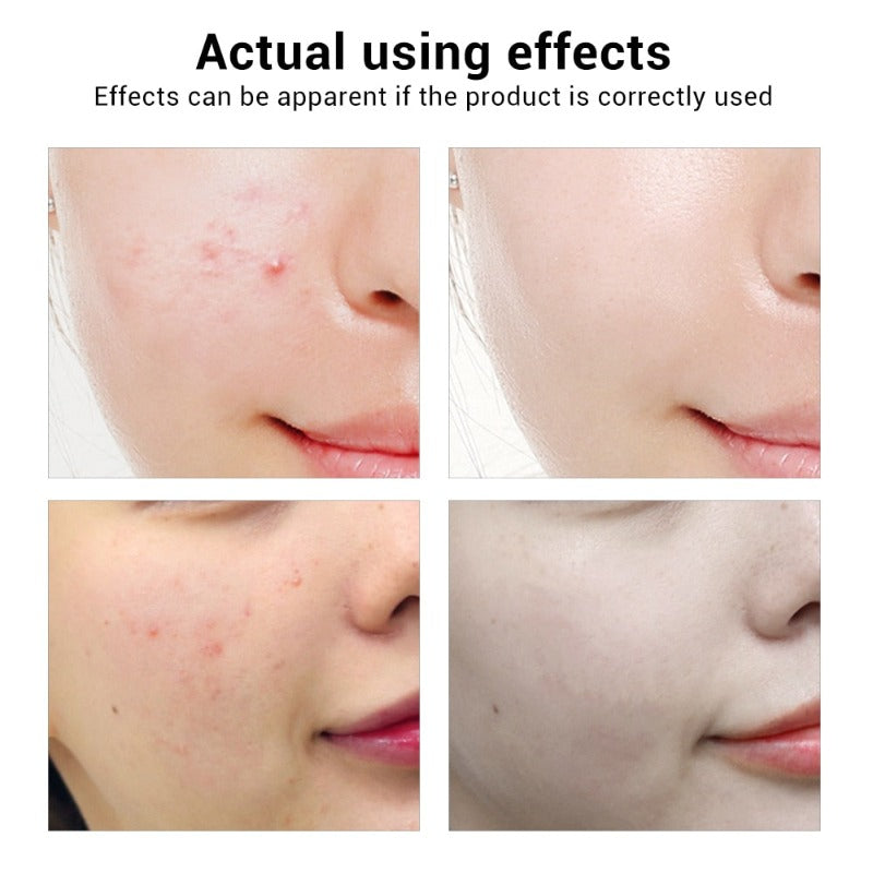 Whitening Essential Oil Niacinamide Anti-Aging Serum Repair Skin 333