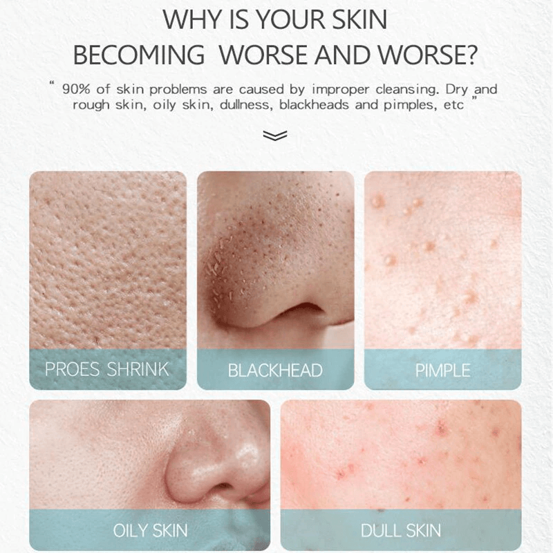 Salicylic Acid Cream Oil Control Anti-Acne Face Cream