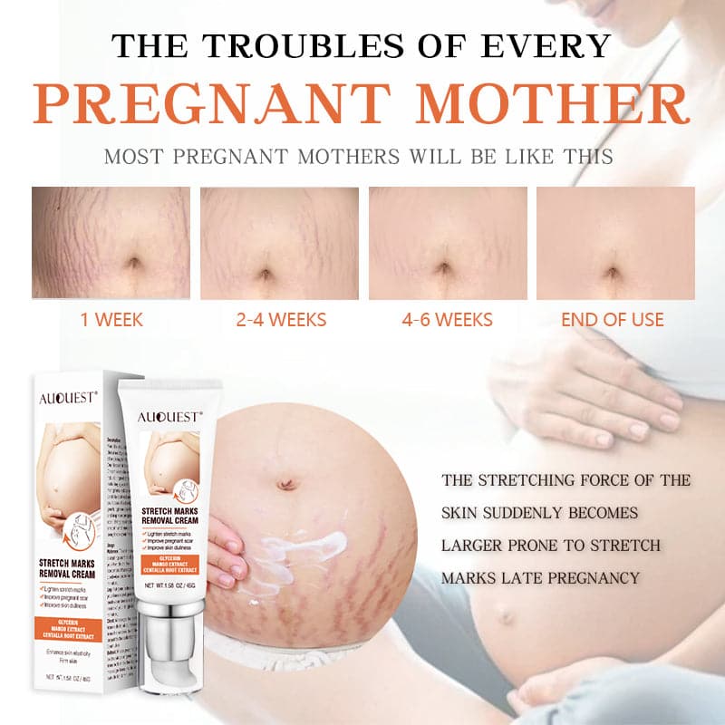 TikTok Maternity Stretch Marks Removal Cream