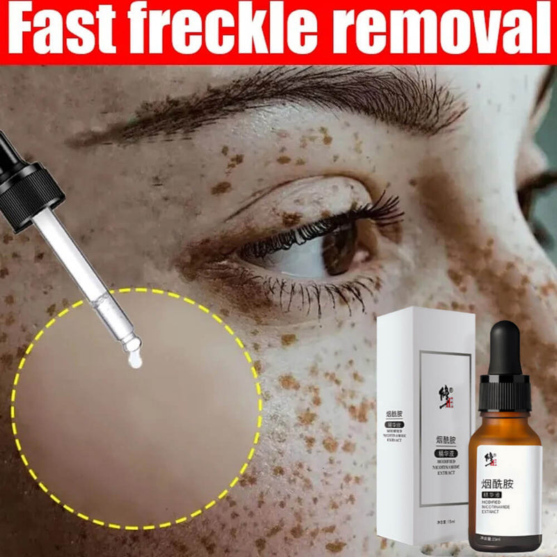 Fast Freckles Remover Serum Nature Dark Spot Remover Skin Brighten Liquid