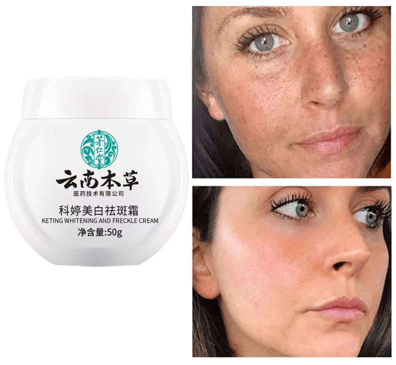 Dr.Hancy Whitening Freckle Cream  Face Moisturizing Face Skin Care 333