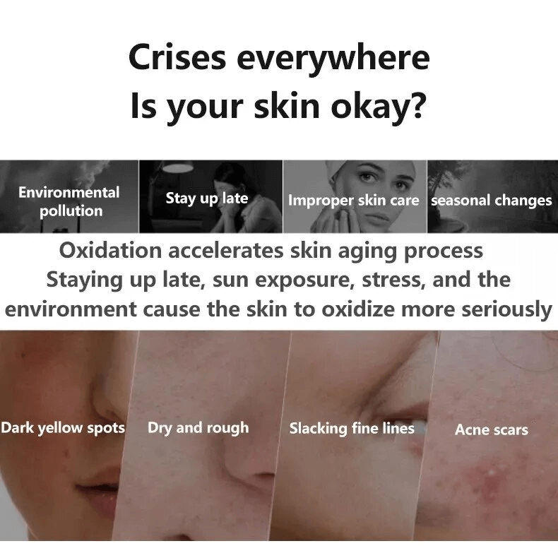 Fast Freckles Remover Serum Nature Dark Spot Remover Skin Brighten Liquid