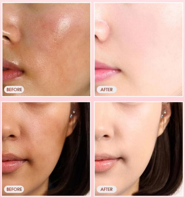 Delena Brightening And Blemish-reducing Moisturizing Hydrating Facial Mask