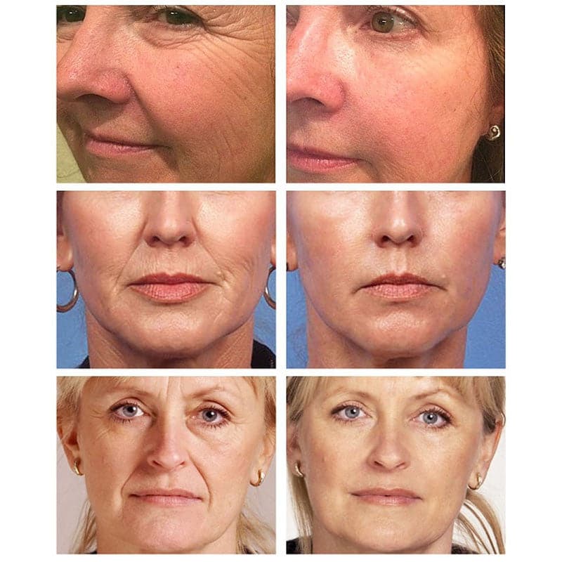 Face Cream Wrinkle Rejuvenation Cream Whitening Firming Moisturizing Face Care