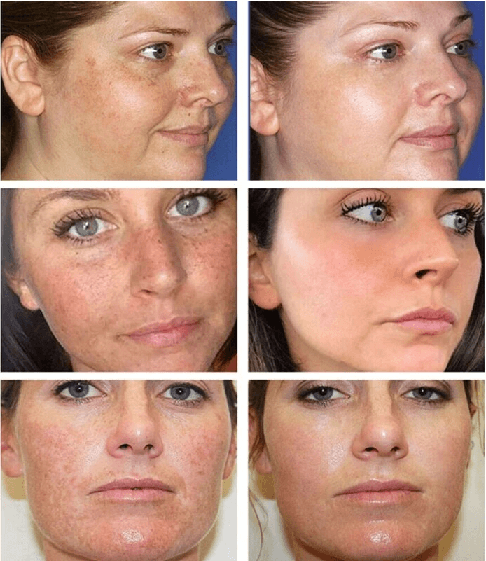 Dr.Hancy Whitening Freckle Cream  Face Moisturizing Face Skin Care 333