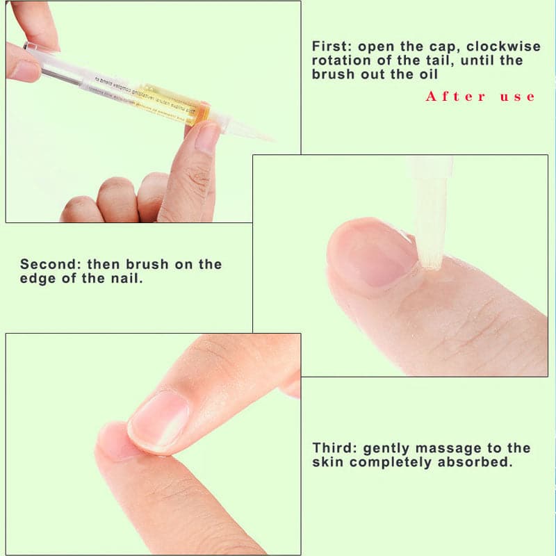 Nail Care Pen Nutritional Oil 5 Scents Cuticle Activating Oil Prevents Nail Aging