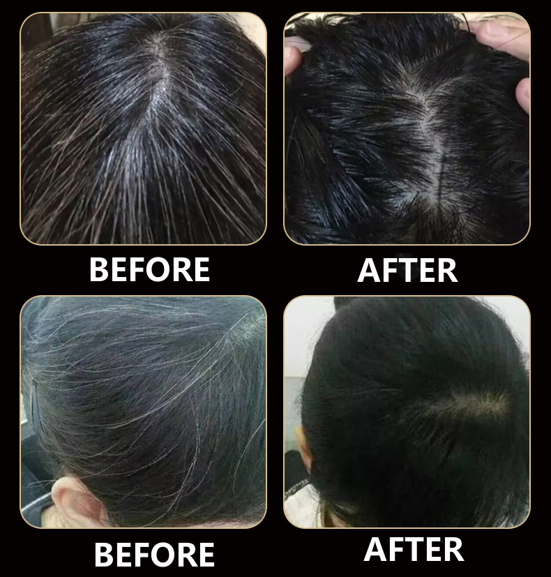 Hair Nutrient Solution For Thinning Hair