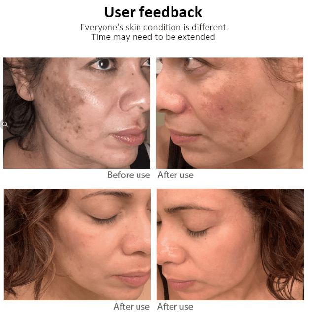 Dr.Hancy Whitening Freckle Cream  Face Moisturizing Face Skin Care 333