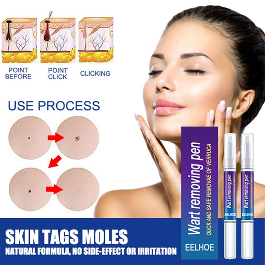 2023 New Removing Against Moles Liquid Pen