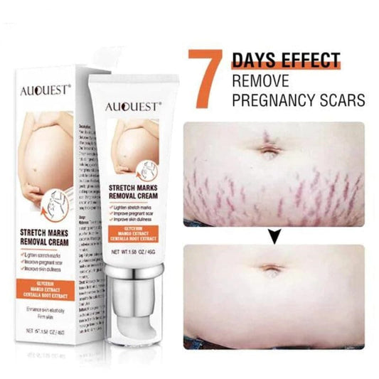 TikTok Maternity Stretch Marks Removal Cream
