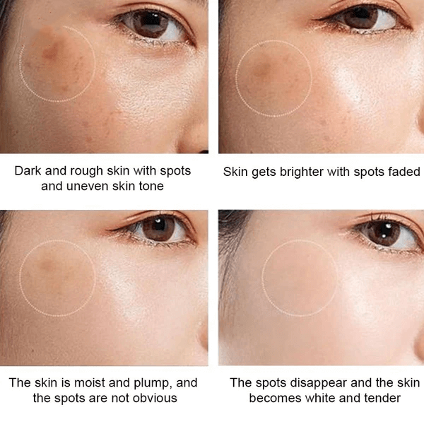 Dr.Hancy Whitening Freckle Cream  Face Moisturizing Face Skin Care 333