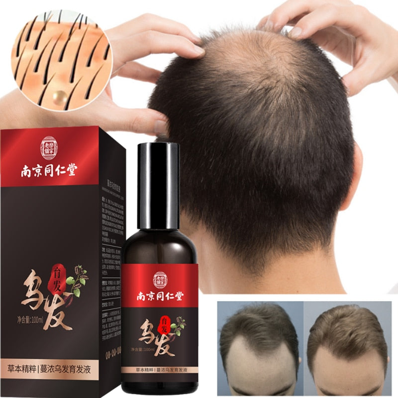 Hair Nutrient Solution For Thinning Hair