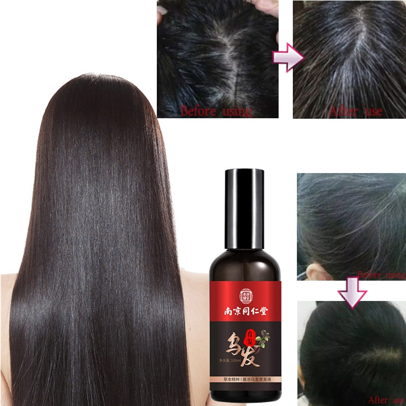 Hair Nutrient Solution For Thinning Hair