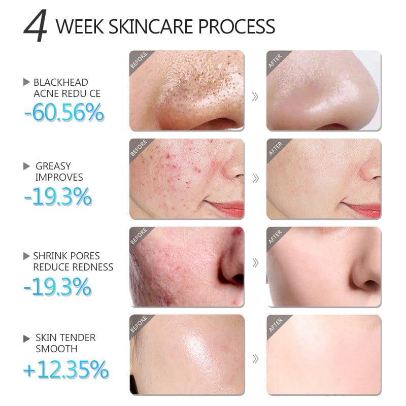 TikTok Shrink Pores Facial Mask Whitening Face Skin Care
