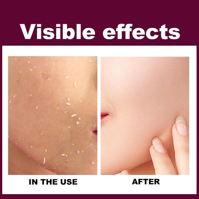 Skin Care Face Exfoliating Cream Whitening Moisturizer Repair